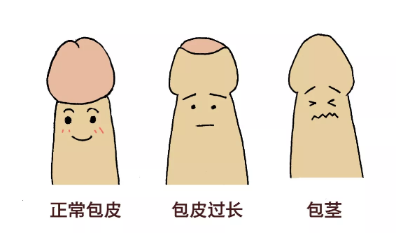 暑假要不要帶孩子去割包皮？這3種情況真得去醫(yī)院 
