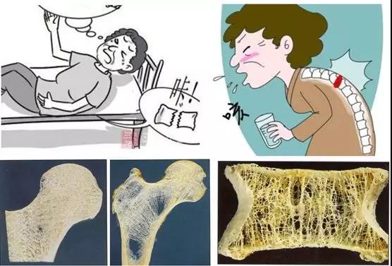 膝關(guān)節(jié)的保養(yǎng)，收藏這篇就夠了 