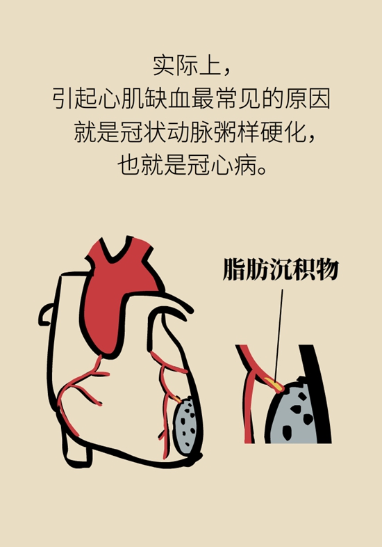 這一類人不適合用速效救心丸，快來自測一下