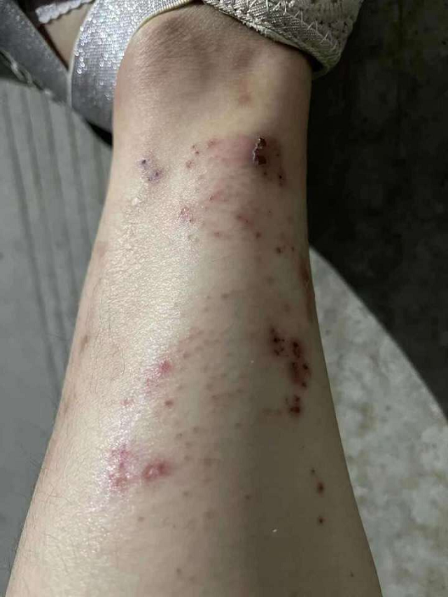 姑娘，你變“丑”了，卻是我們眼中最美的天使