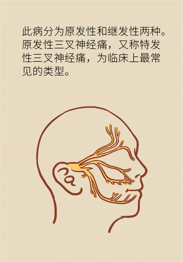 這種疼痛不是牙疼？緩解三叉神經(jīng)痛就用這兩招