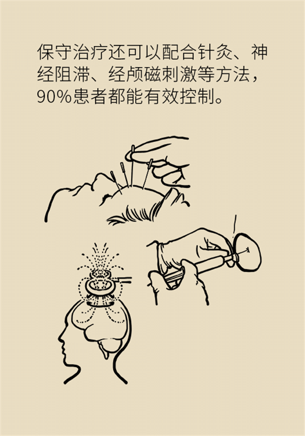 這種疼痛不是牙疼？緩解三叉神經(jīng)痛就用這兩招