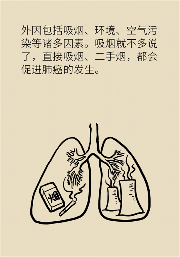 肺部結(jié)節(jié)會(huì)變成肺癌嗎？這些人群要警惕