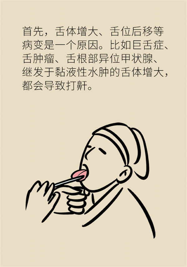 睡覺打鼾怎么辦？6個(gè)小妙招輕松緩解