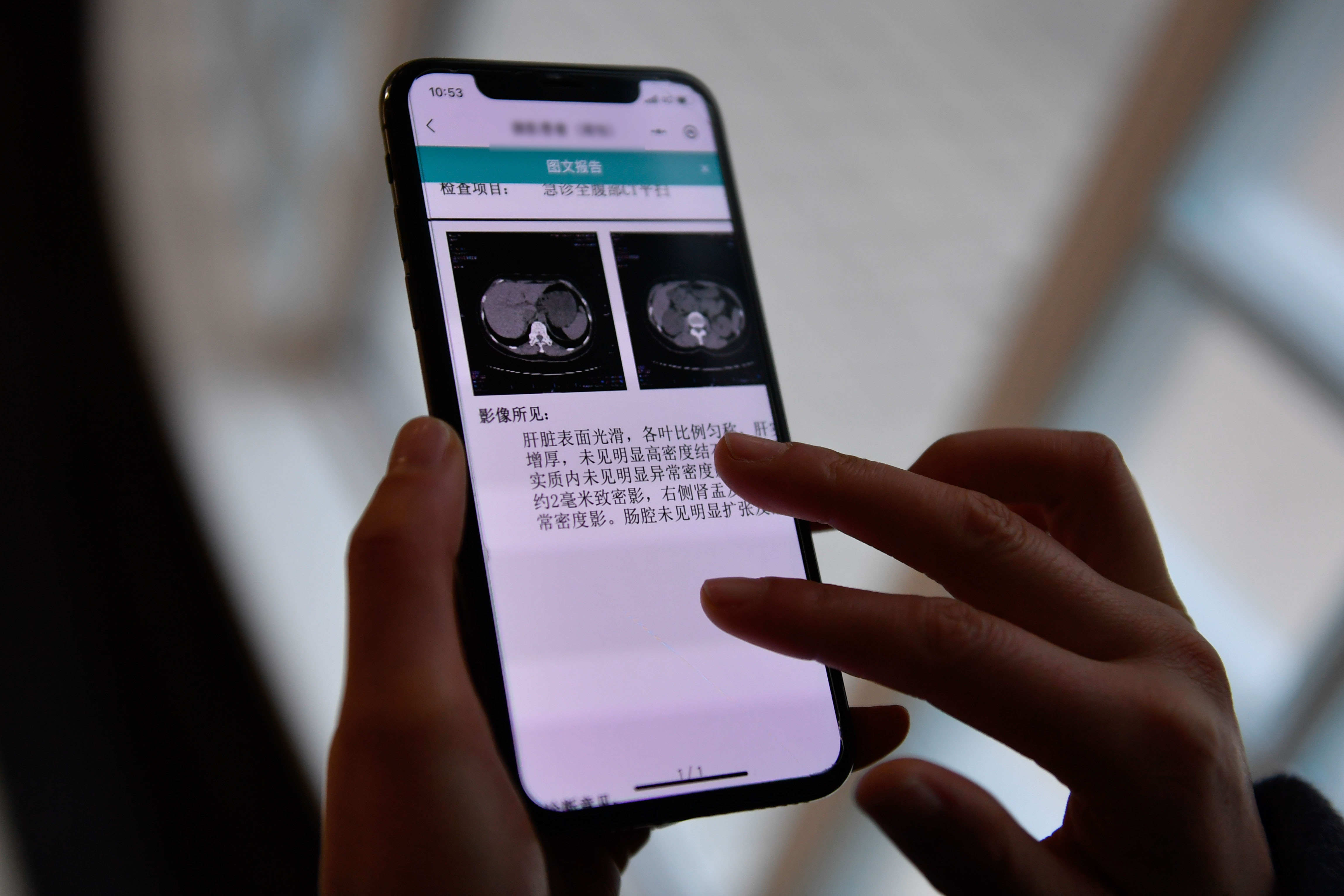 “現(xiàn)代化最重要的指標(biāo)還是人民健康”——寫(xiě)在第15個(gè)全民健身日之際