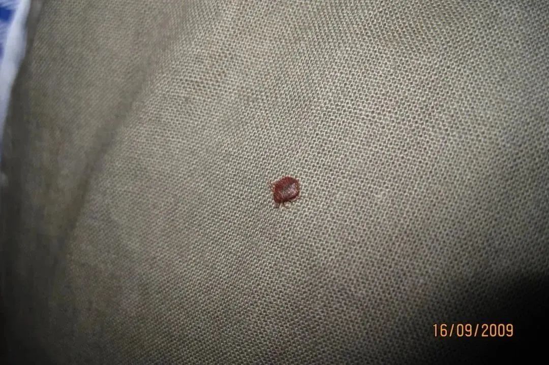 以人類血液為食！多國爆發(fā)，已蔓延至亞洲