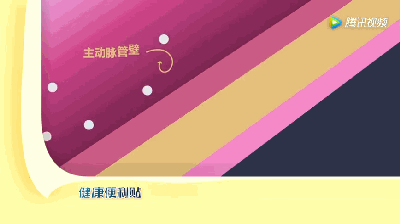 5天接診4例A型主動脈夾層，到底有多兇險