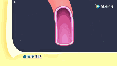 5天接診4例A型主動脈夾層，到底有多兇險