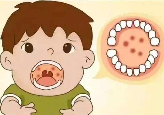 緊急提醒！這種病進(jìn)入高發(fā)期 注意預(yù)防