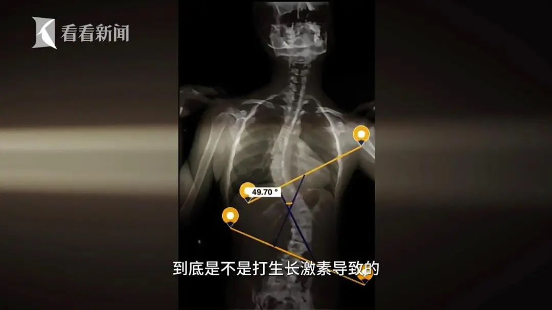 焦慮的家長擅自給孩子打“增高針”，醫(yī)生：需專業(yè)評估否則存風(fēng)險