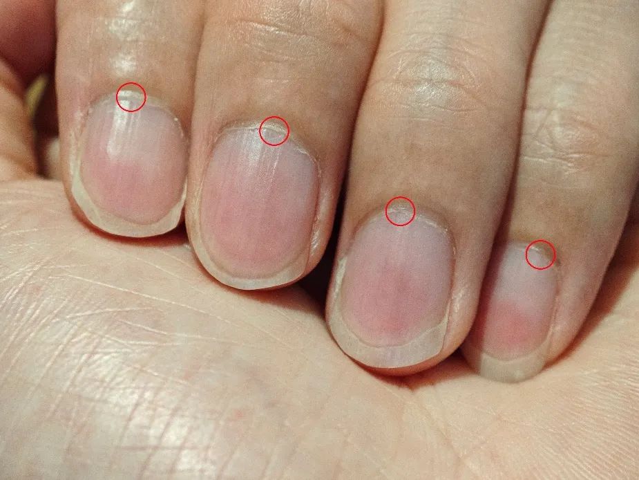 手指也會(huì)感染HPV？這件事很多女生都愛做，一定要注意