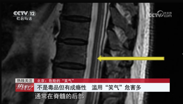  成癮、致幻，嚴重可致死！它不是毒品，卻像毒品一樣危險