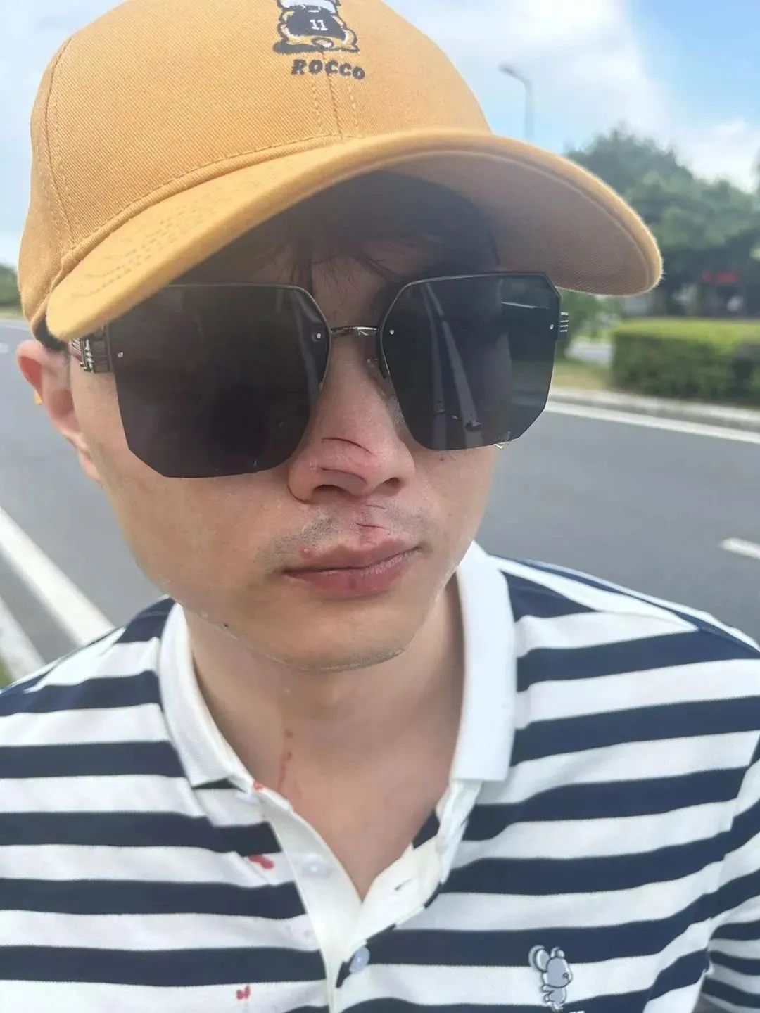 無人機(jī)傷人，飛手該擔(dān)何責(zé)？律師解讀