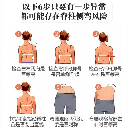 為什么好好的孩子越來(lái)越畸形了?這些姿勢(shì)不注意 小心變成“問(wèn)題兒童”