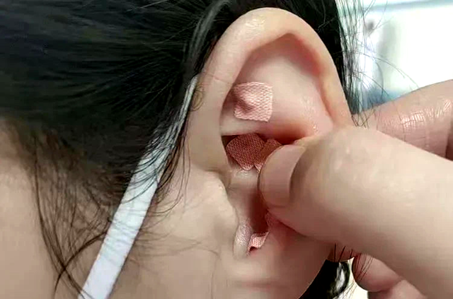 睡眠不好？中醫(yī)耳穴壓豆有妙招