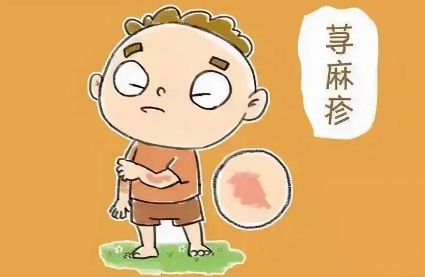 麻疹：你以為它消失了?其實(shí)它就在你身邊
