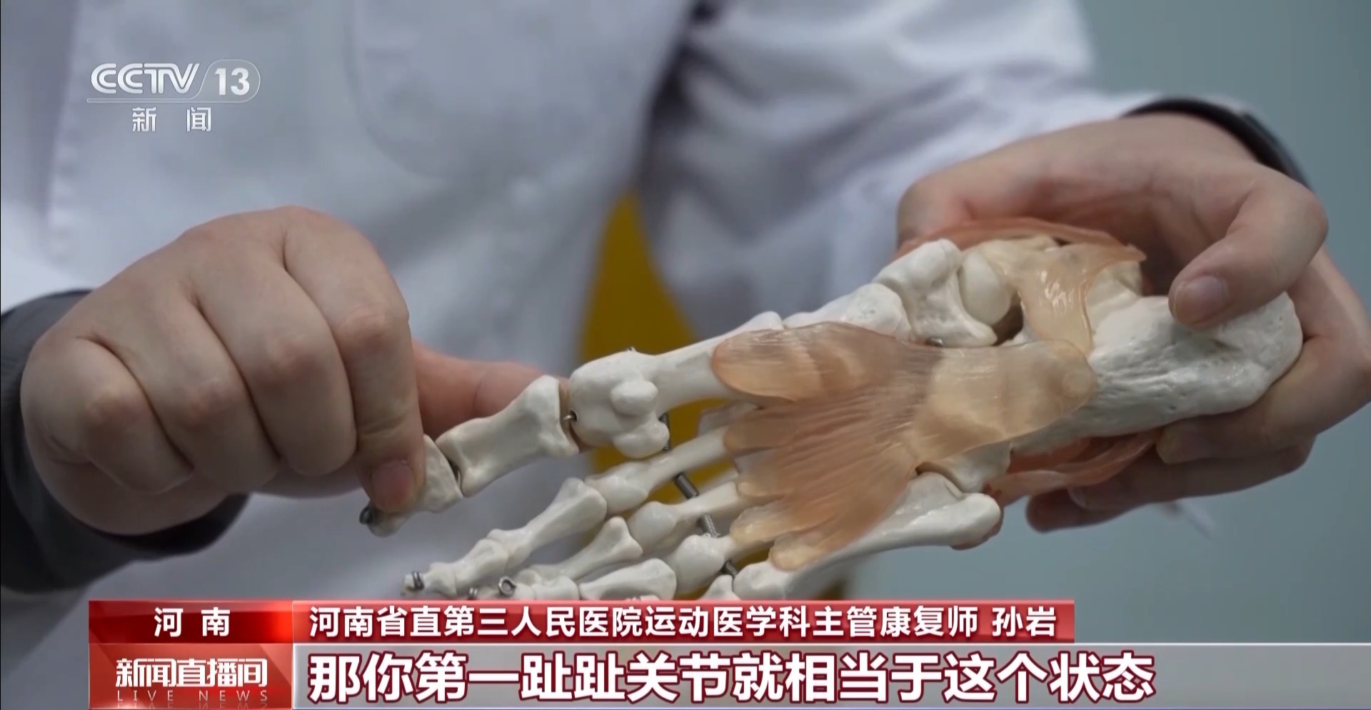 瘋狂種草碳板跑鞋？醫(yī)生：足底筋膜炎警告！