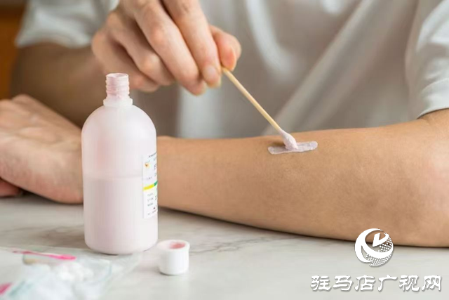 爐甘石洗劑并非“萬能神藥” 這些情況要慎用！