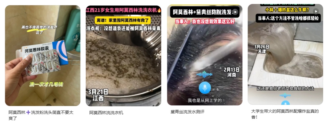 用阿莫西林洗頭，能治療脫發(fā)？別信！