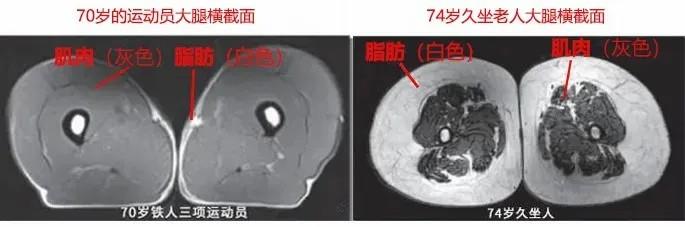 運動是加速衰老，還是延緩衰老？真相揭開