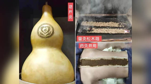 冬病夏治正當時，駐馬店市第二中醫(yī)院即將開展2025三伏貼、三伏灸服務