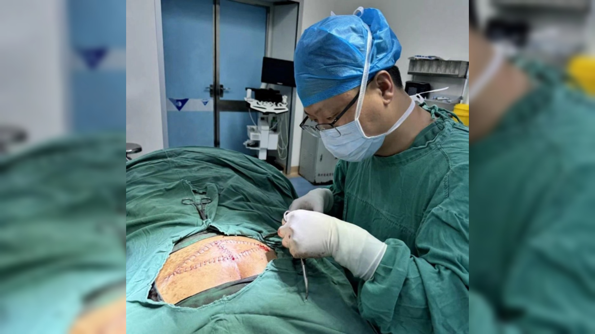 多學科接力守護！駐馬店市第一人民醫(yī)院成功救治臥床老人“深可見骨”褥瘡