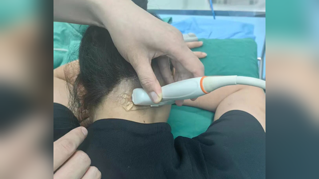 鄭州大學(xué)附屬腦病醫(yī)院（駐馬店市第二人民醫(yī)院）：為破十年偏頭痛，她從廣州來到駐馬店