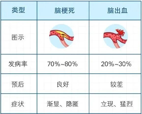 腦梗高發(fā)季到了！有3種不舒服，千萬別大意