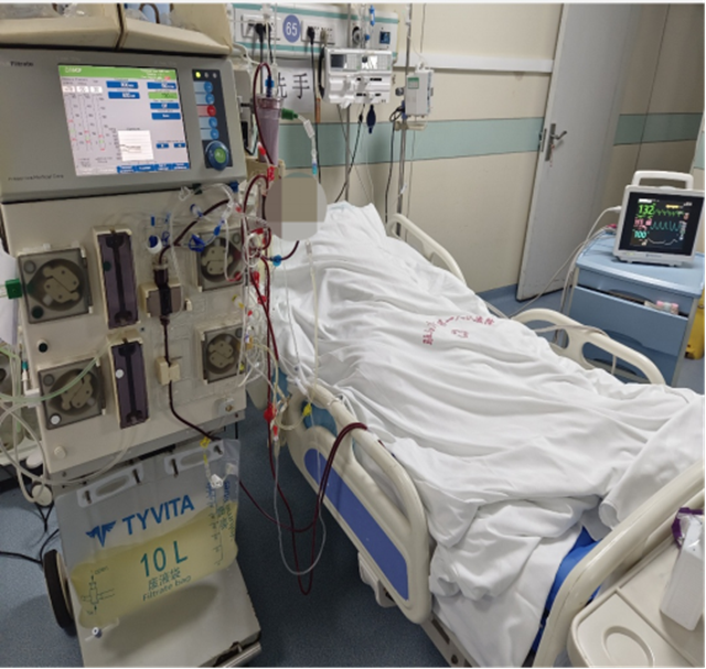 重癥醫(yī)學(xué)科聯(lián)合血液凈化科成功救治腎衰合并心衰患者  床旁連續(xù)血液凈化治療顯威力，危急時刻守護生命