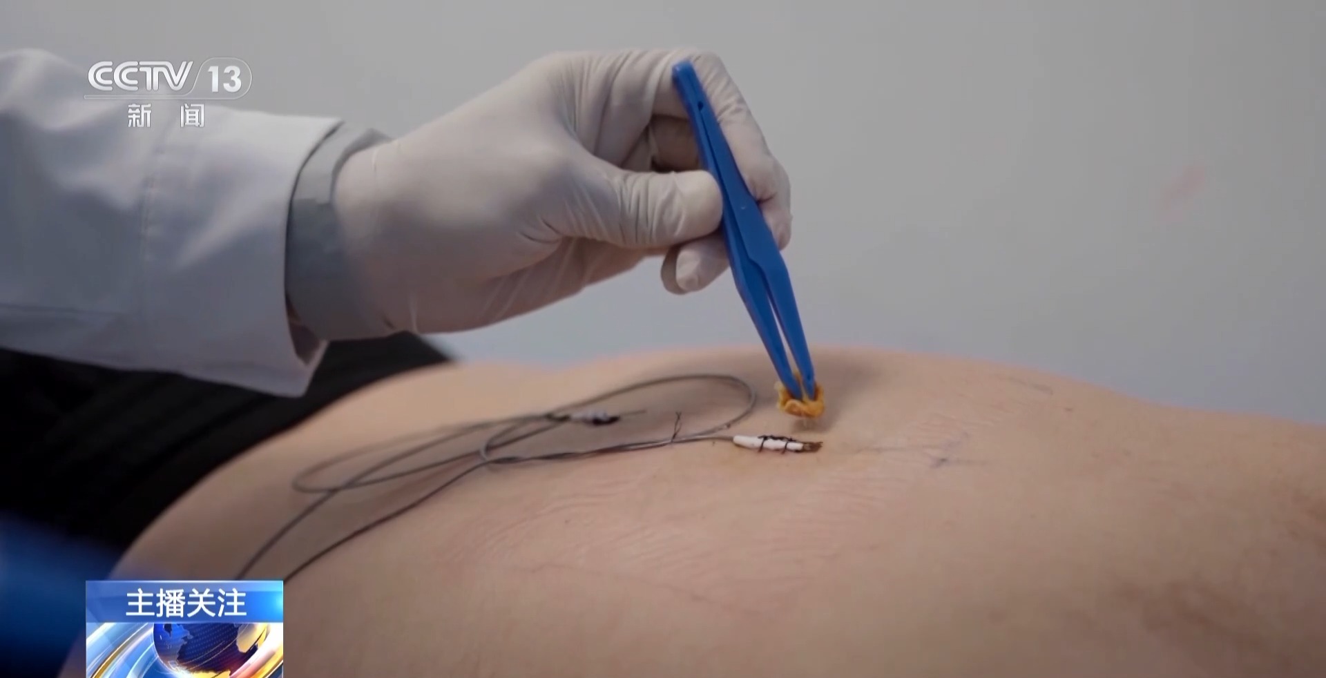 老年人遇到這些身體疼痛勿硬扛 或是健康重要預(yù)警信號