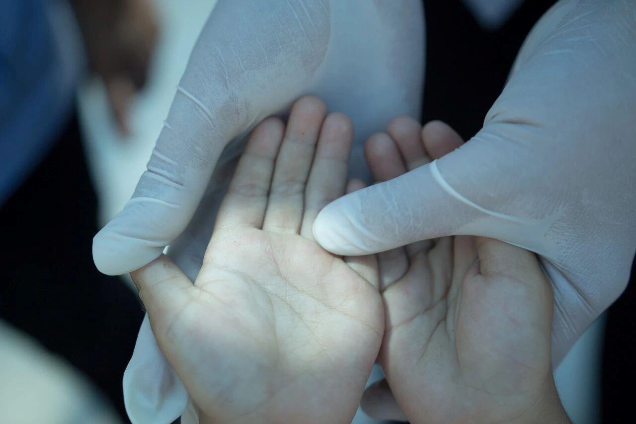 關(guān)于手足口病的8個常見誤區(qū)，一次說清！