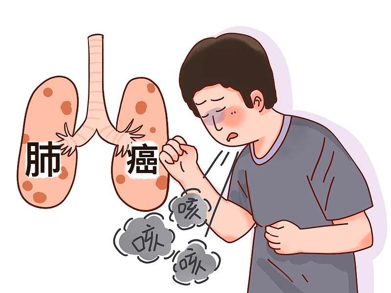 肺癌一發(fā)現(xiàn)就是晚期？身體給出的暗示，不要忽視